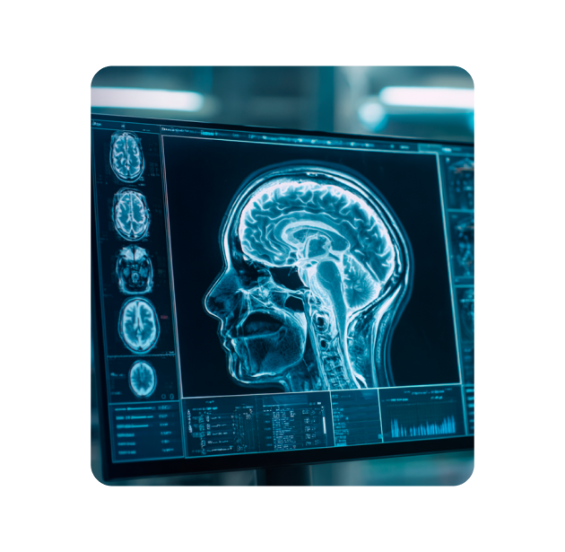 Máster de Formación Permanente en Epilepsia